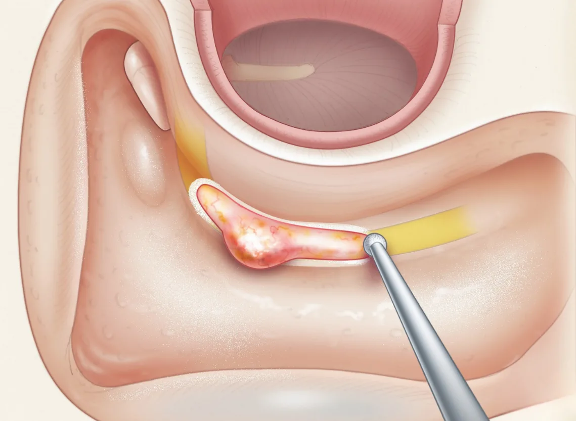 Facial nerve evaluation at Niraaya Hospital