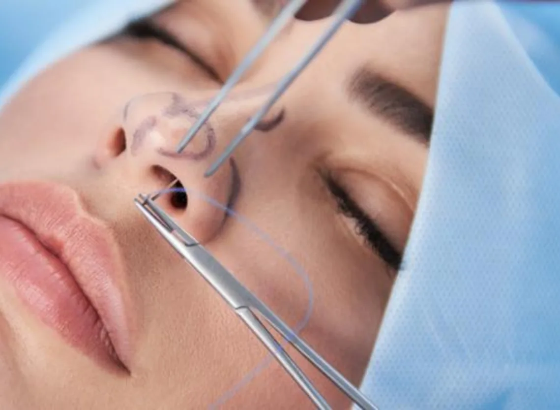 Septoplasty at Niraaya Hospital