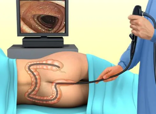 Colonoscopy consultation at Niraaya Hospital