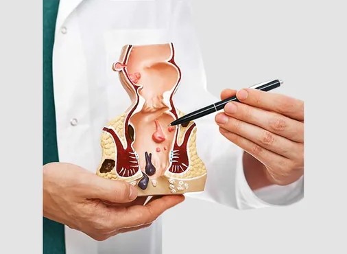 Proctology