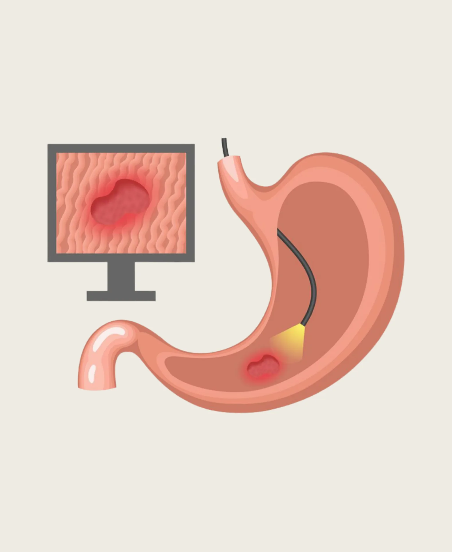 Dr. Neel Patel - Endoscopy care at Niraaya Hospital Gandhinagar