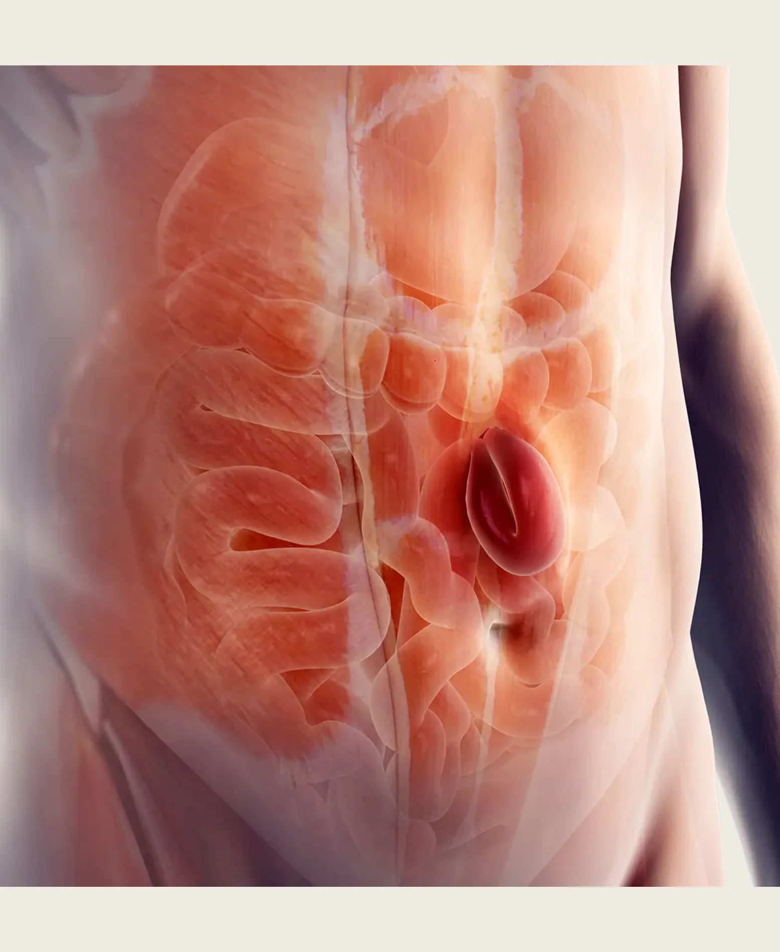 Dr. Neel Patel - Hernia care at Niraaya Hospital Gandhinagar